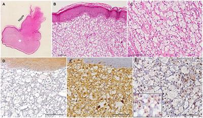 Nipple Hibernoma in a Dog: A Case Report With Literature Review